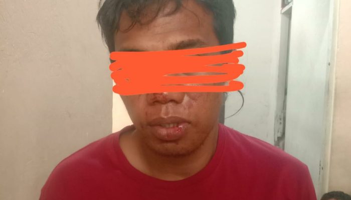 Polisi Amankan Pelaku Penganiayaan Seorang Pria Hingga Korban Kehilangan 4 Jari Tangan Kiri